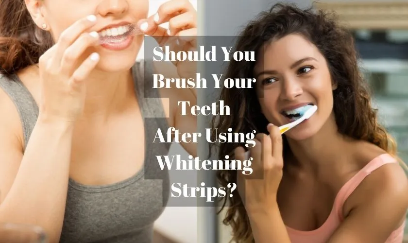 31814 types of teeth whitening
