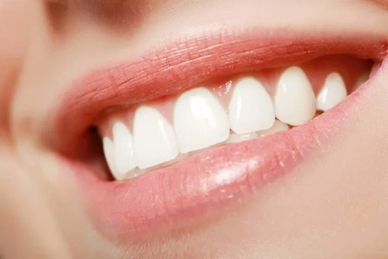 31819 dentist teeth whitening