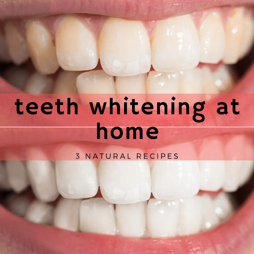 31822 teeth whitening sensitive teeth