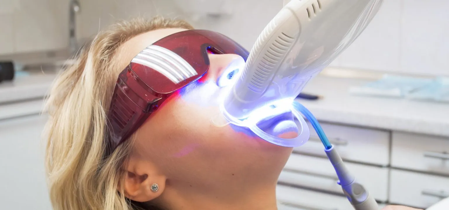 31842 at home teeth whitening