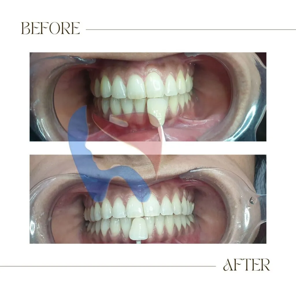 31843 destiny usa teeth whitening products