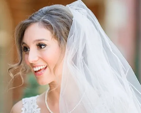 31844 teeth whitening jackson ms image2