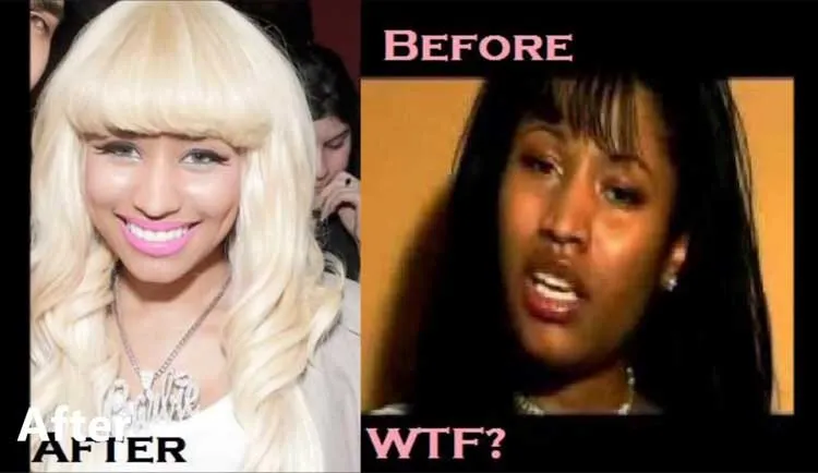 31845 nicki minaj skin whitening image5