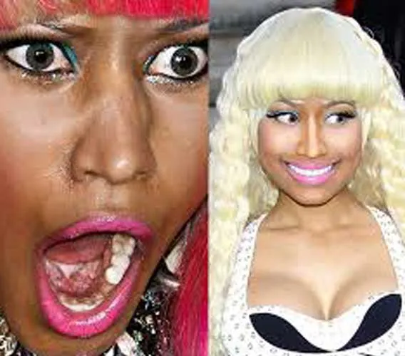 31845 nicki minaj skin whitening image6