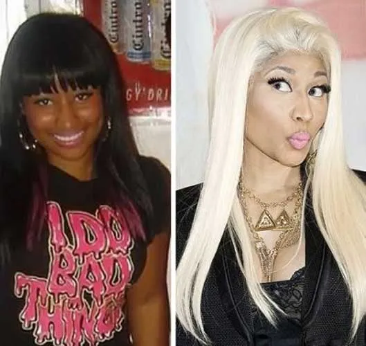 31845 nicki minaj skin whitening image7