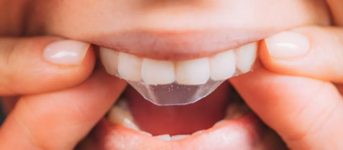 31848 uneven whitening