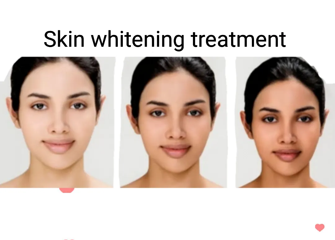 31849 skin whitening injection treatment