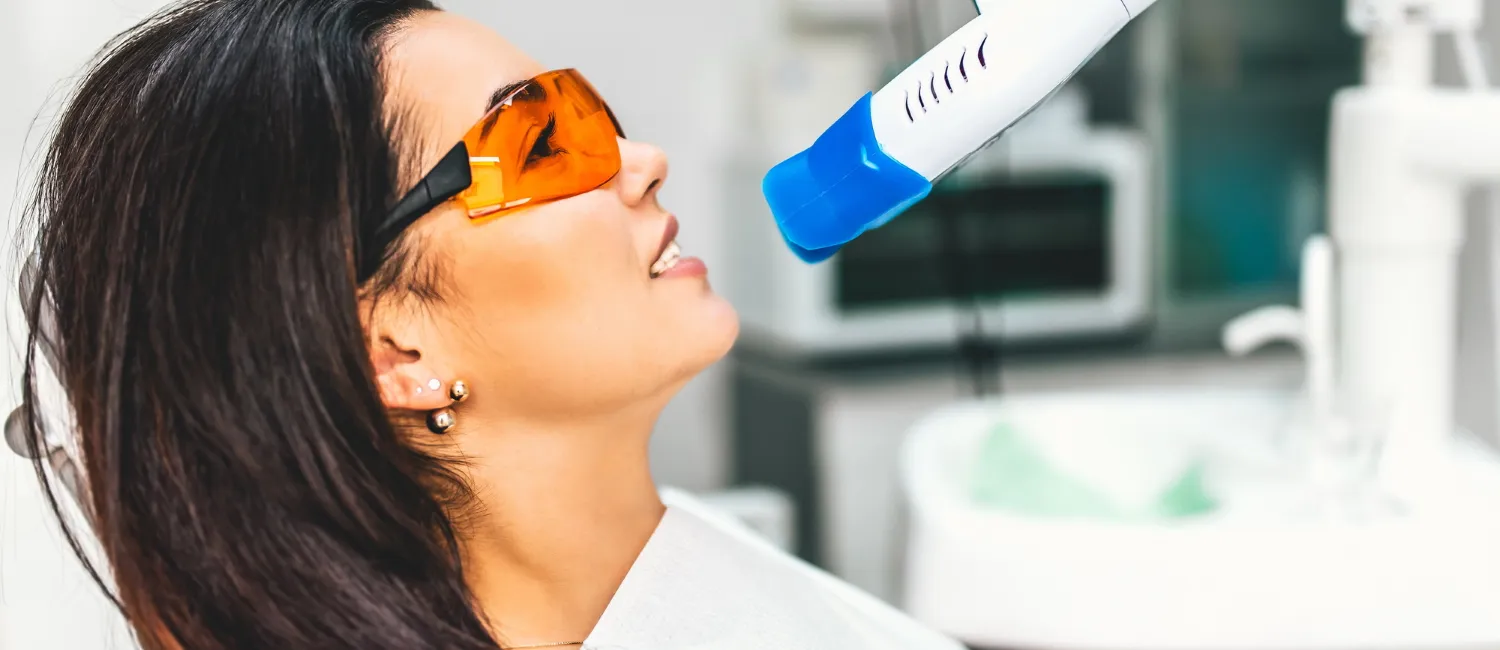 31850 professional teeth whitening