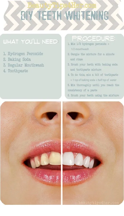 31861 teeth whitening guide