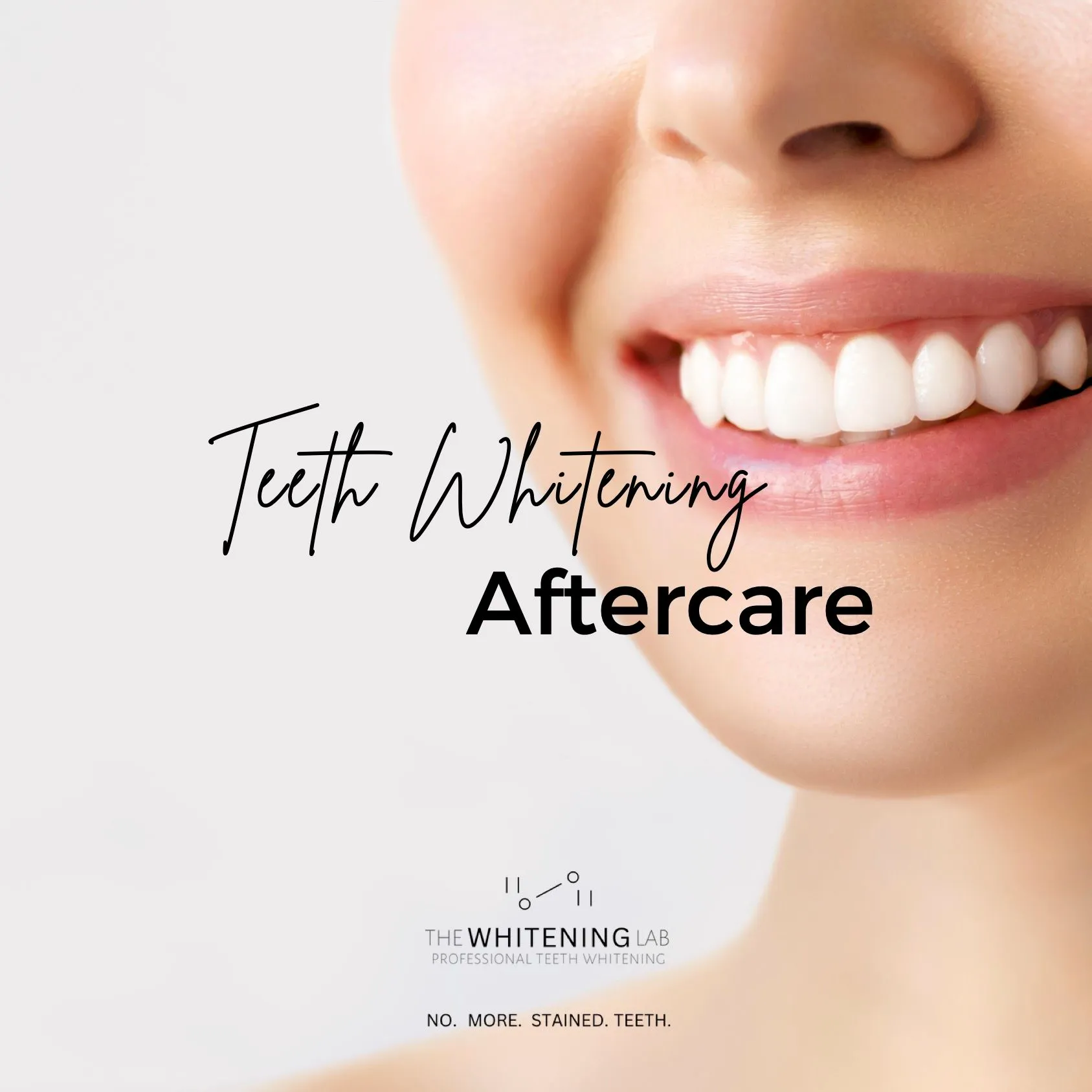/img/31872-teeth-whitening-maintenance.webp