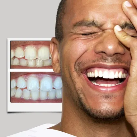 31878 avoid staining foods