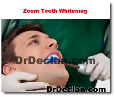 /img/31888-teeth-whitening-maintenance.webp