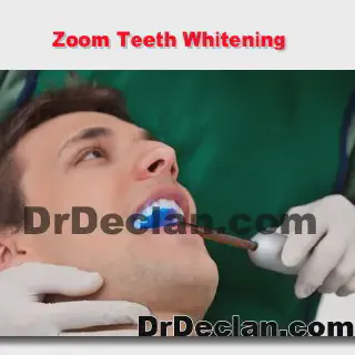 /img/31888-teeth-whitening-maintenance.webp