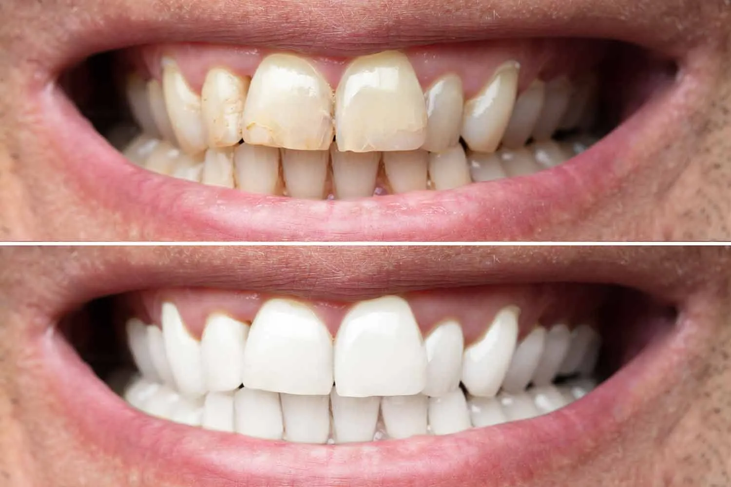 /img/31898-teeth-whitening-products.webp