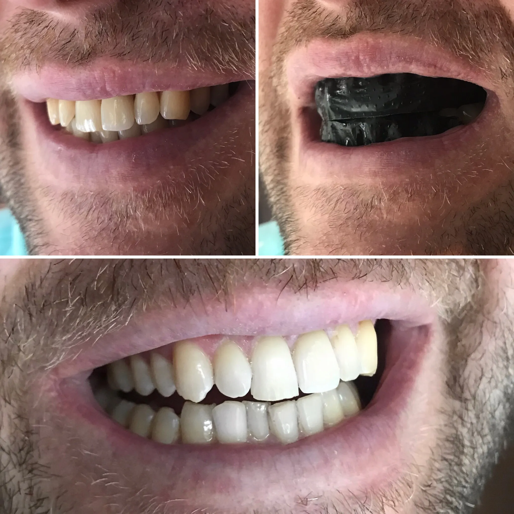 31916 consumption habits