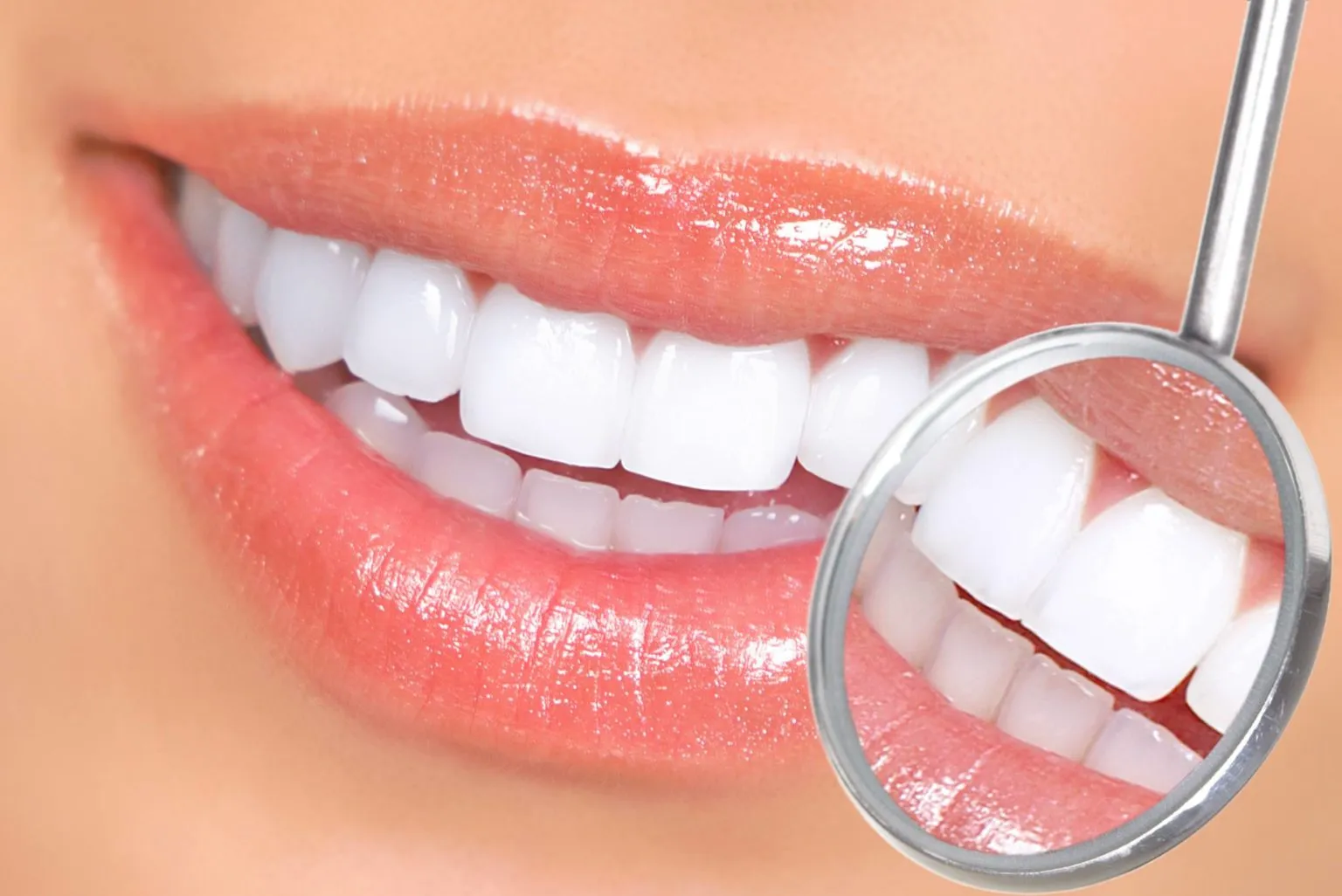 31919 teeth whitening stockton image1