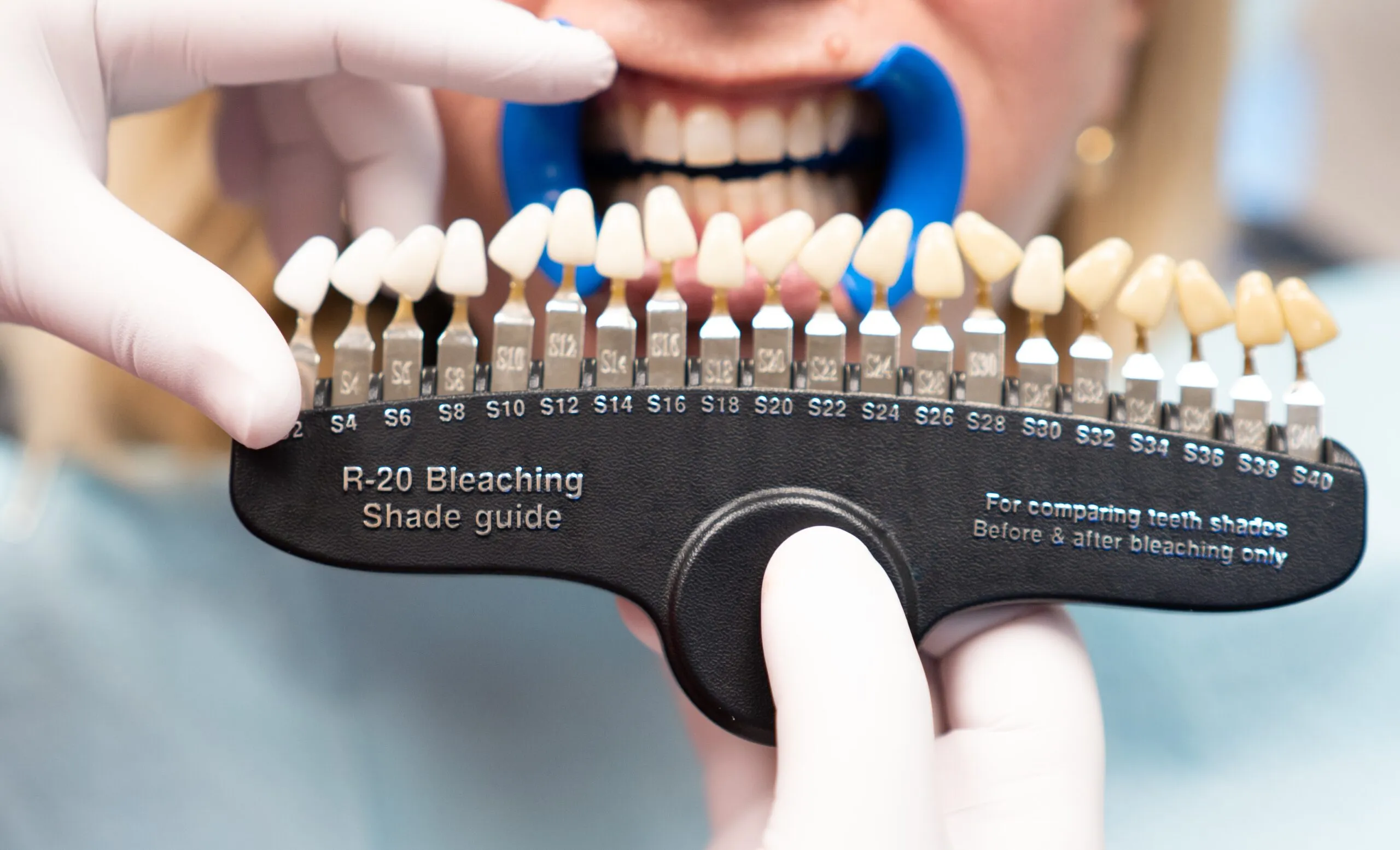 31919 teeth whitening stockton image2