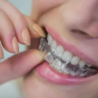 /img/31919-teeth-whitening-stockton-image8.webp