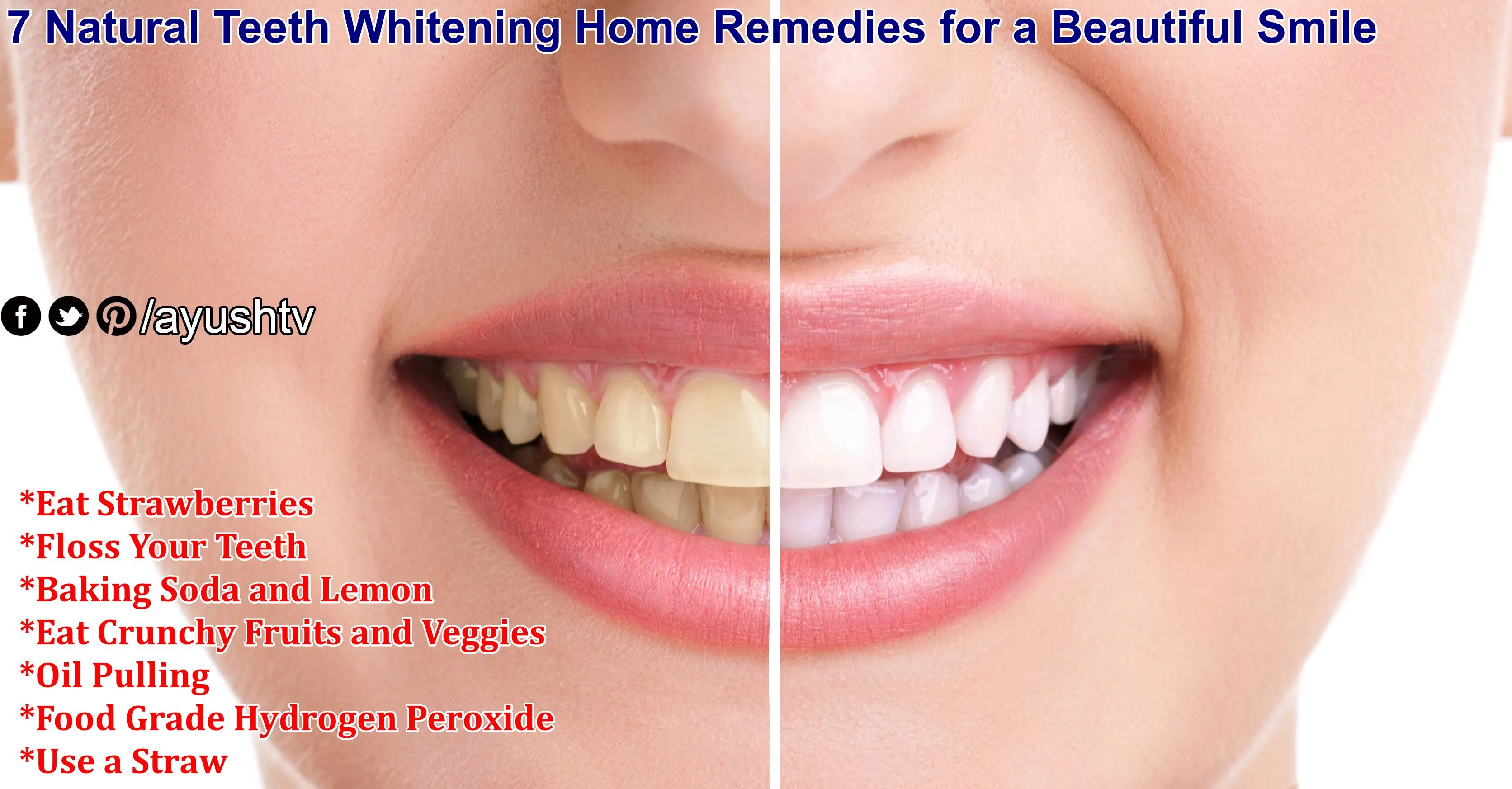 31933 teeth whitening comparison