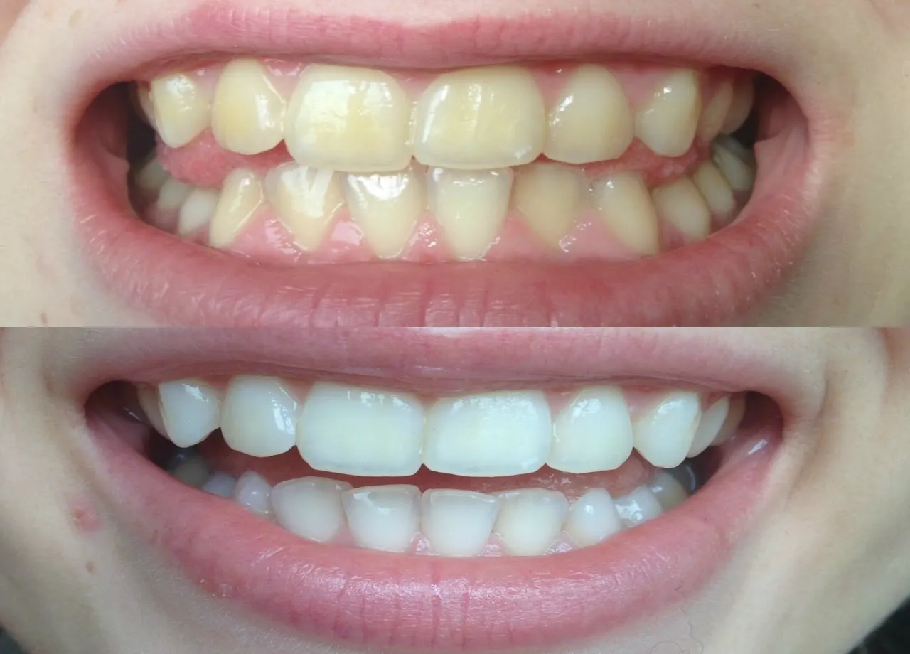 31938 dental professional