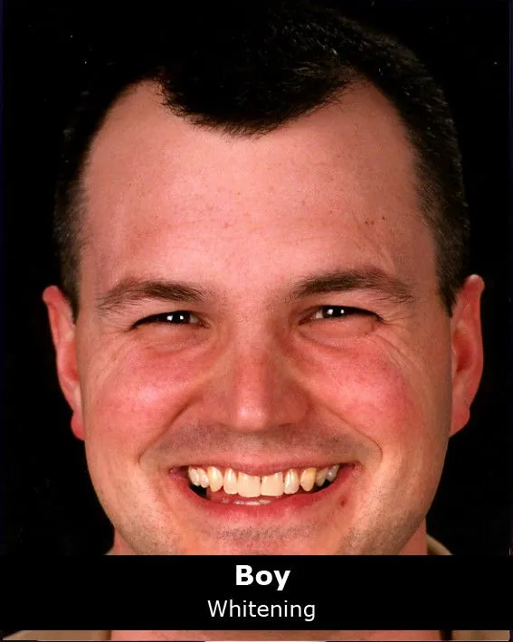 31951 resume whitening image4