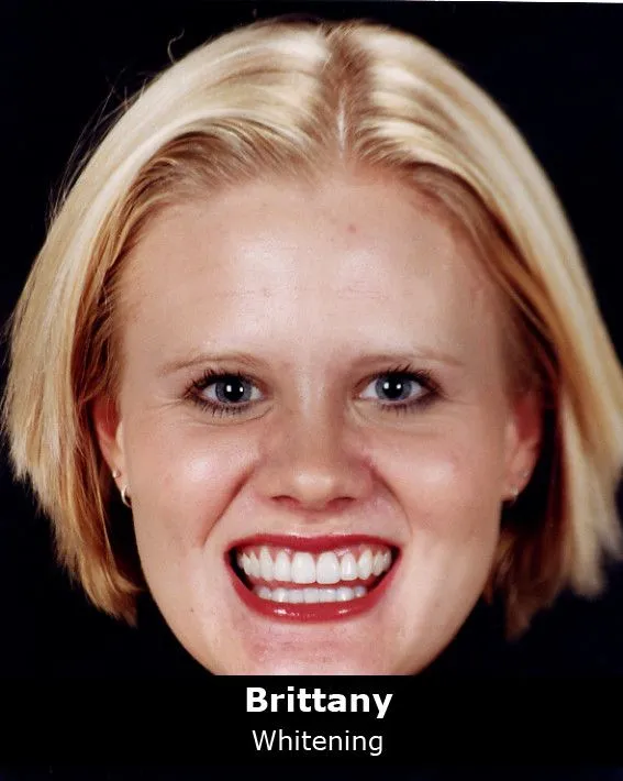 31951 resume whitening image5