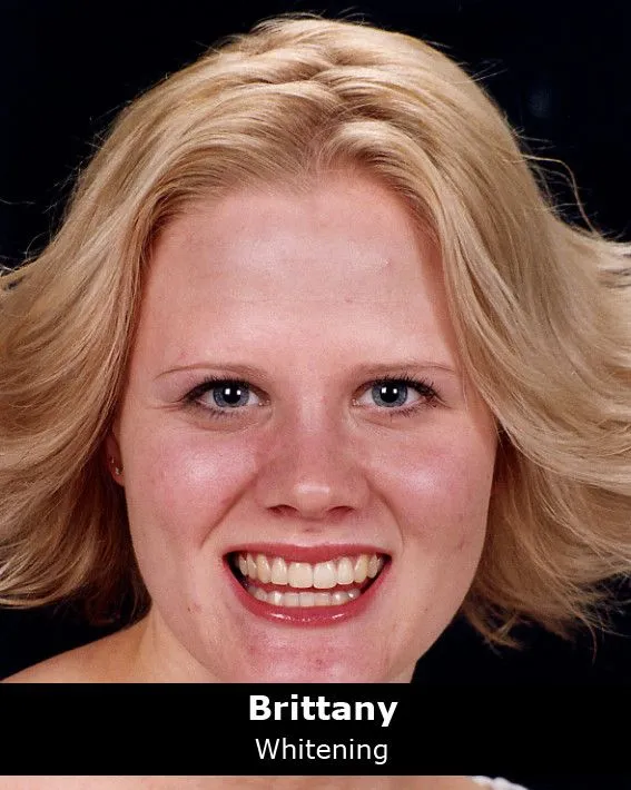 31951 resume whitening image6