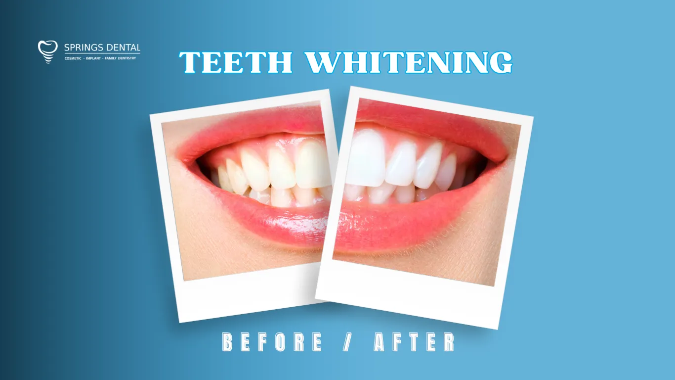 31959 whitening toothpastes