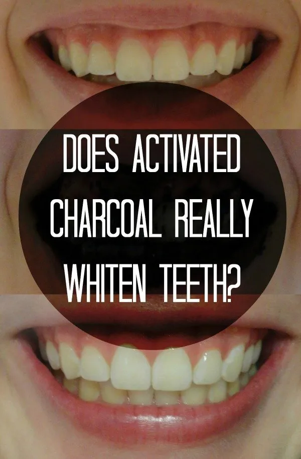 31966 charcoal teeth whitening