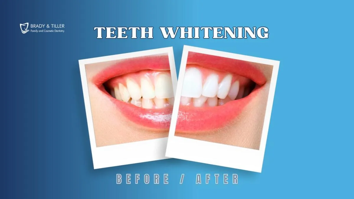 /img/31970-teeth-sensitivity.webp