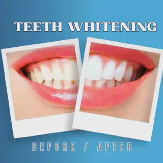 /img/31970-teeth-sensitivity.webp
