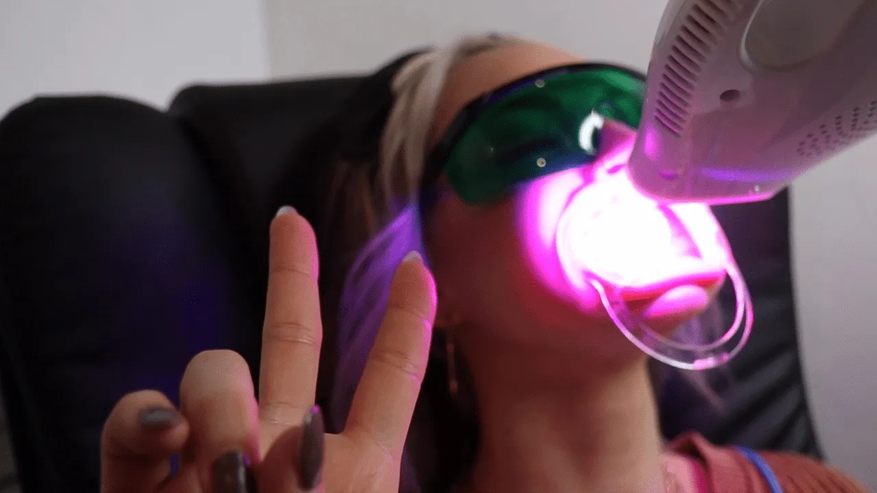 31982 laser teeth whitening