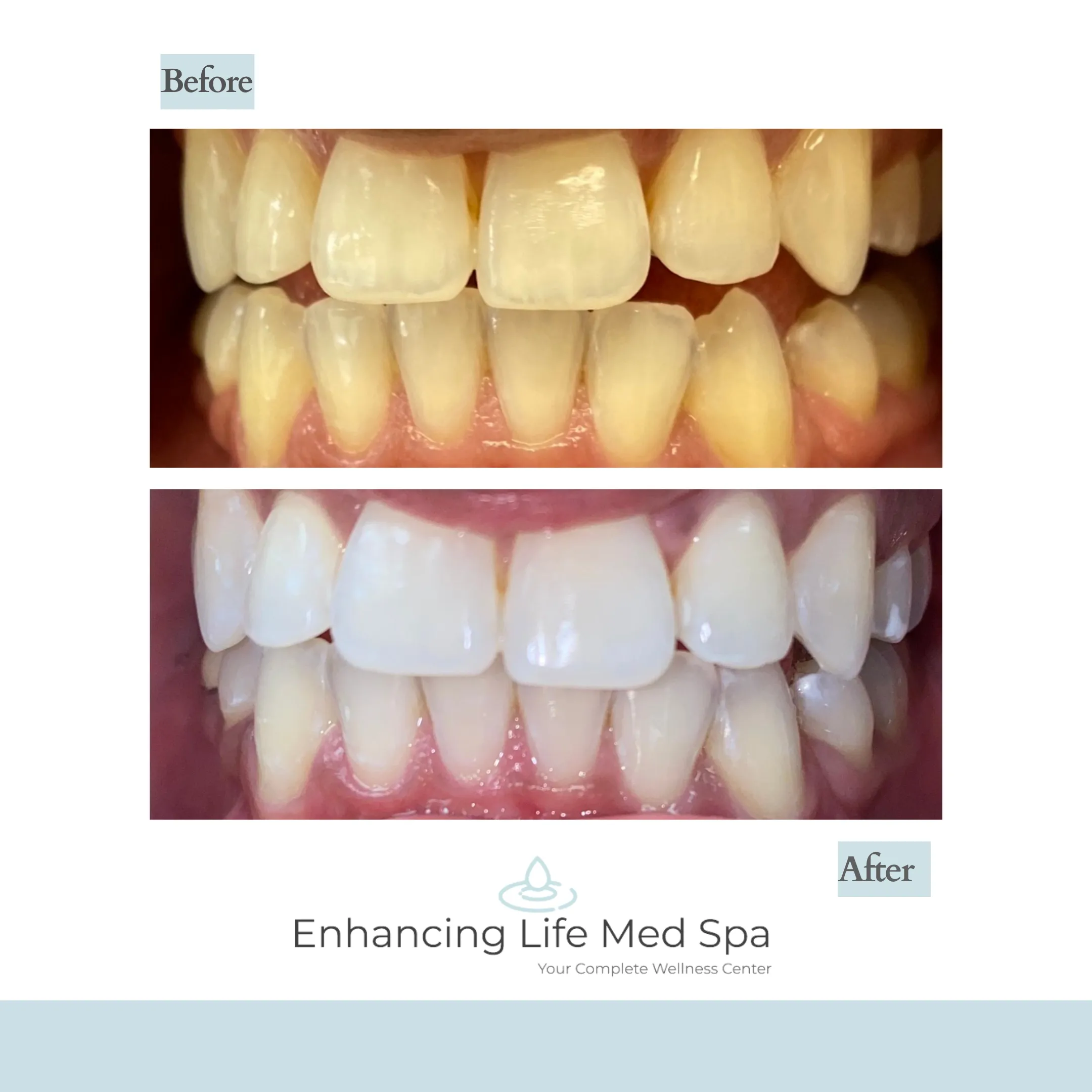 31988 confident smile