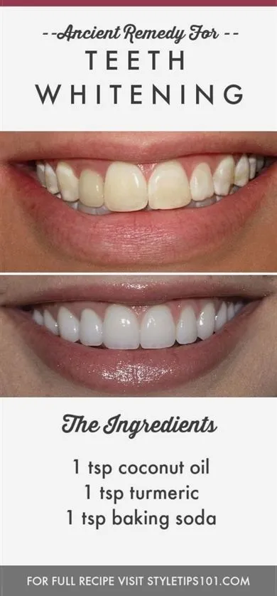 31996 regular dental checkups 7