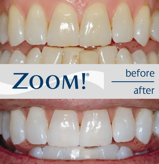 32003 maintaining white smile