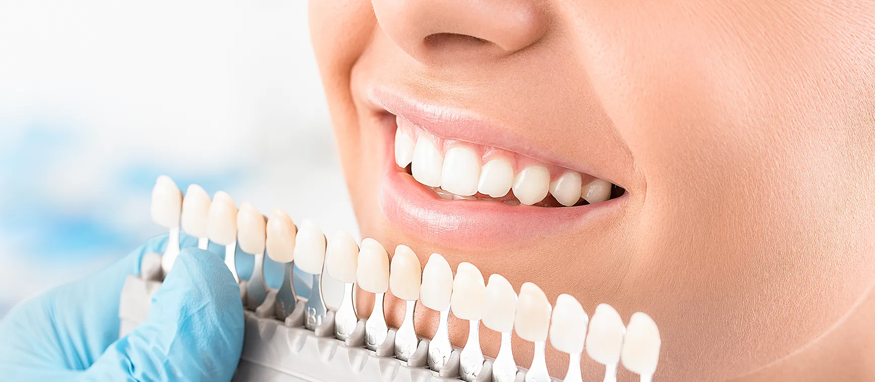 32004 teeth whitening hialeah smile