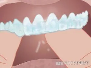 32007 opalescence products