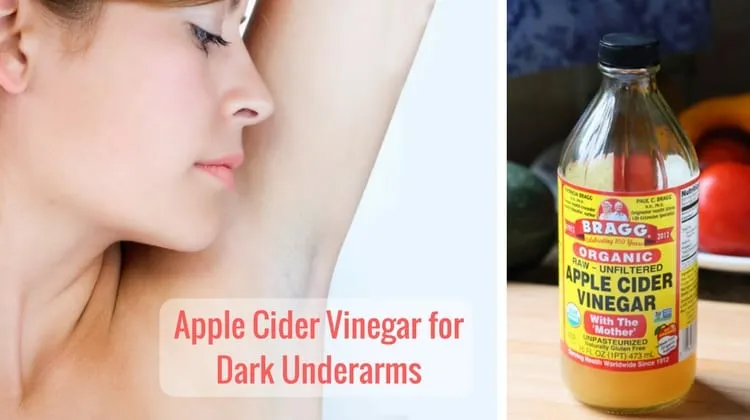 32012 apple cider vinegar bottle