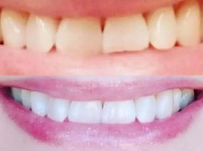 32017 avoiding staining