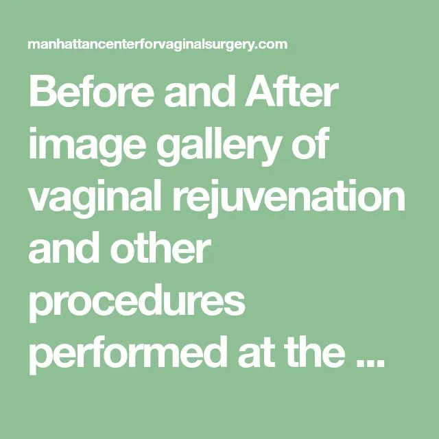 32018 qualified practitioner