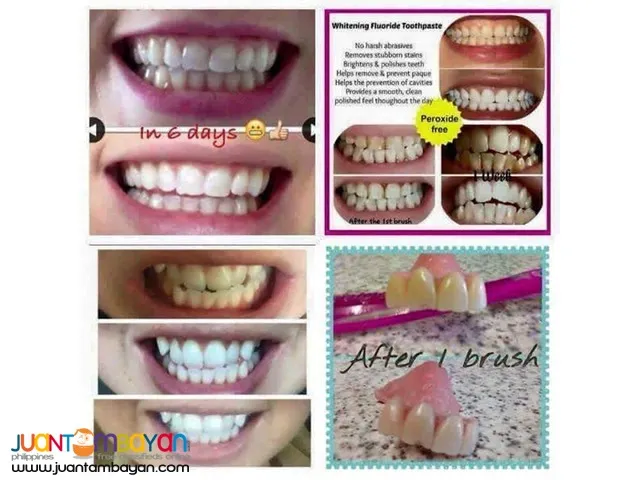 32020 ap24 teeth whitening results