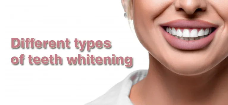 32024 in office whitening