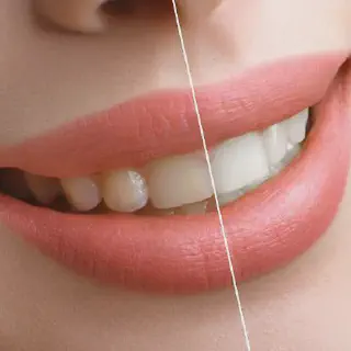 /img/32024-natural-teeth-whitening.webp