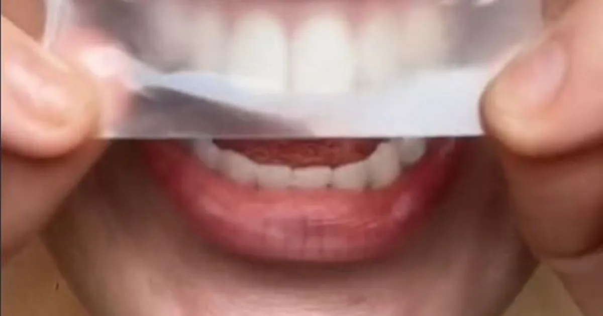 32031 whitening strips before after