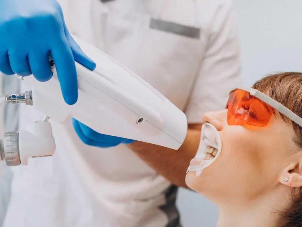 32032 laser teeth whitening candidate