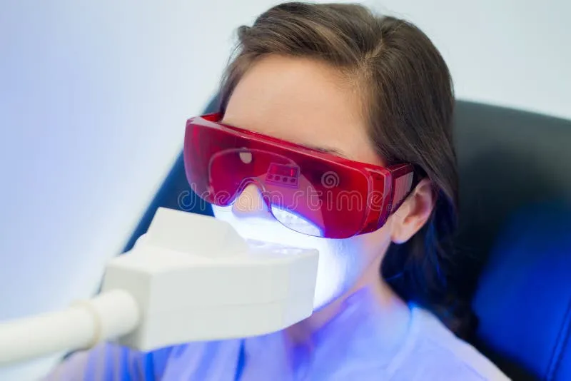 32032 laser teeth whitening cost