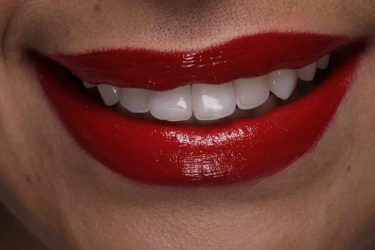 32041 teeth whitening strips