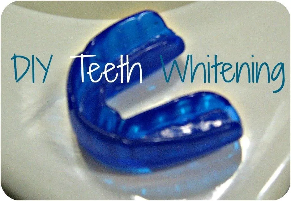 32042 stained teeth examples