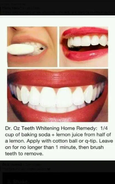 32042 strawberry teeth whitening