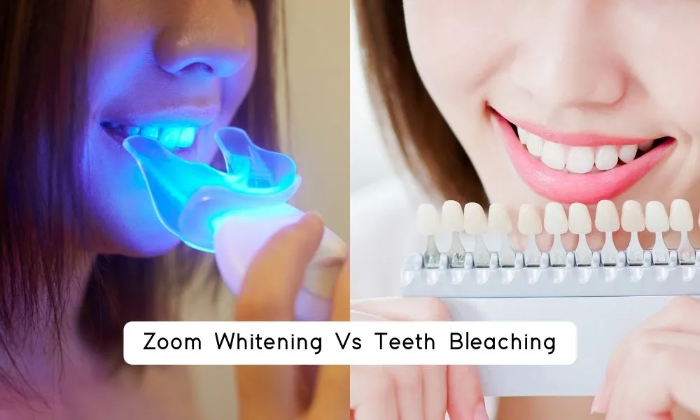 /img/32046-teeth-whitening-options.webp